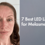 7 Best LED Light for Melasma (2026 Top Picks)