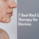 7 Best Red Light Therapy Devices for Scars (2026)