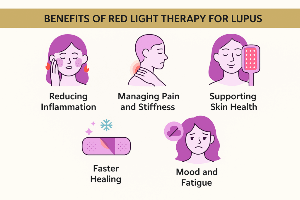 An infographic titled "Benefits of Red Light Therapy for Lupus" features five illustrations: 1) A woman holding her face, labeled "Reducing Inflammation," 2) A person rubbing their neck, labeled "Managing Pain and Stiffness," 3) A woman using a red light therapy device, labeled "Supporting Skin Health," 4) A healing bandage icon, labeled "Faster Healing," and 5) A tired-looking woman, labeled "Mood and Fatigue." The background is beige with a gold header.