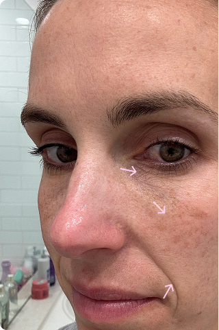 before-img