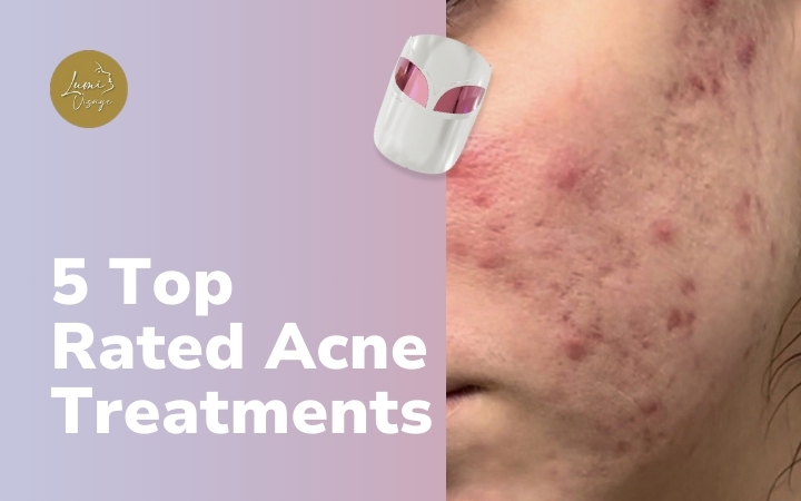 5 Top Rated Acne Treatments