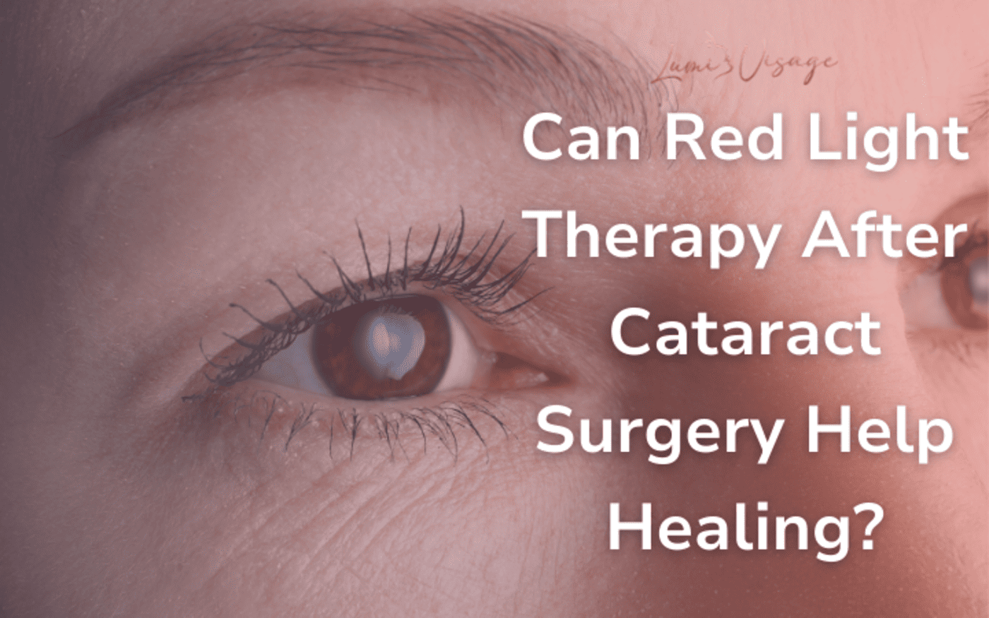 Can Red Light Therapy After Cataract Surgery Help Healing?
