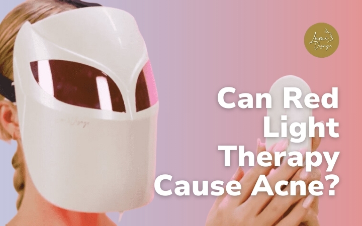Can Red Light Therapy Cause Acne