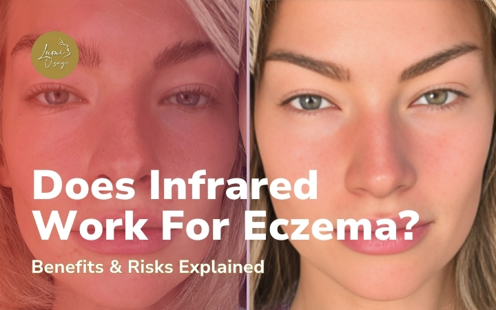 Does Infrared Work For Eczema