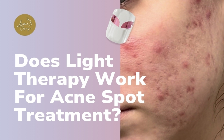 Does Light Therapy Work For Acne Spot Treatment