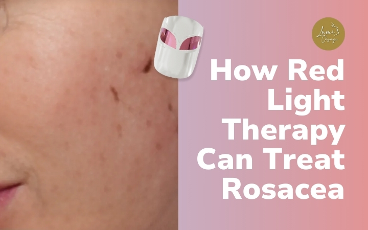 How Red Light Therapy Can Treat Rosacea-2