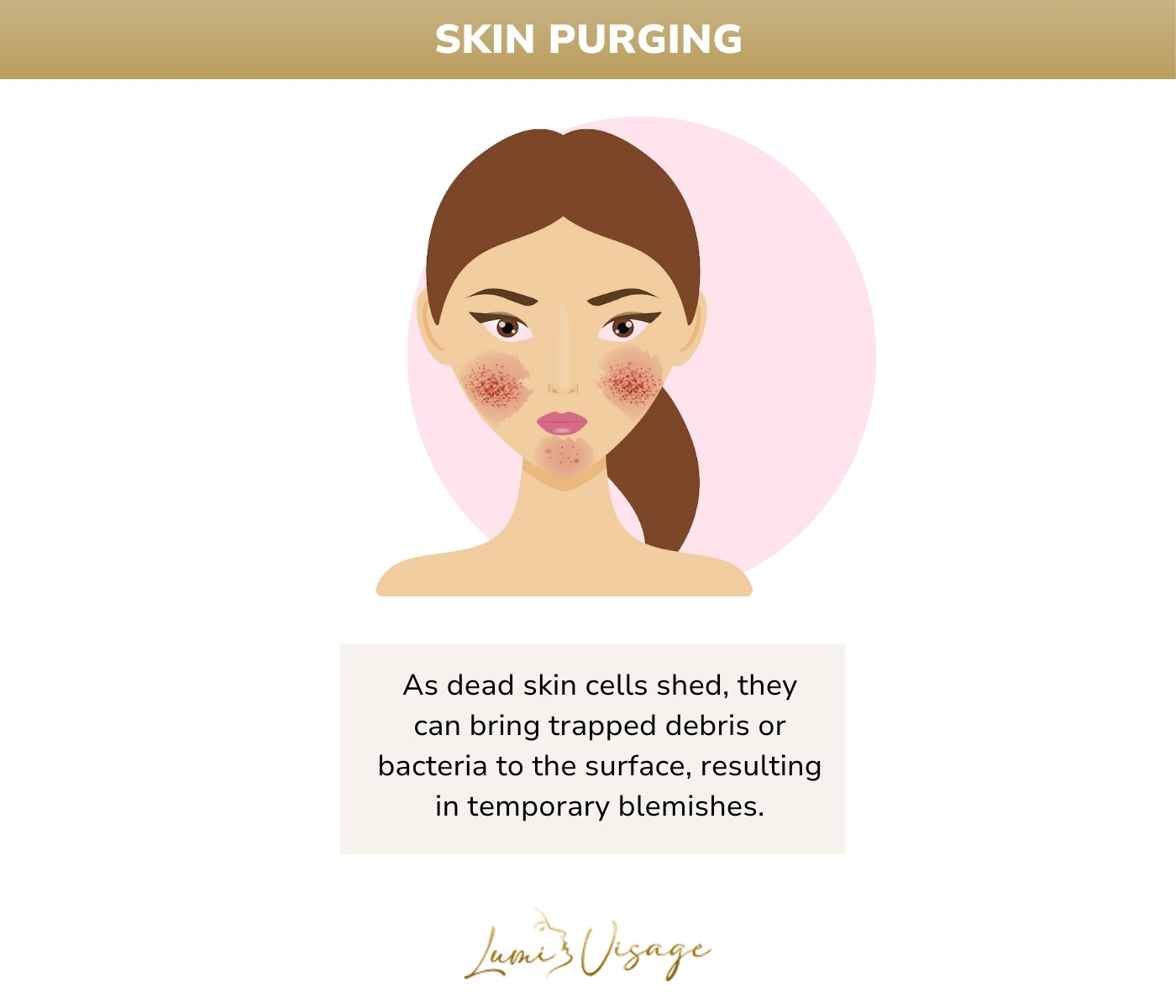skin purging