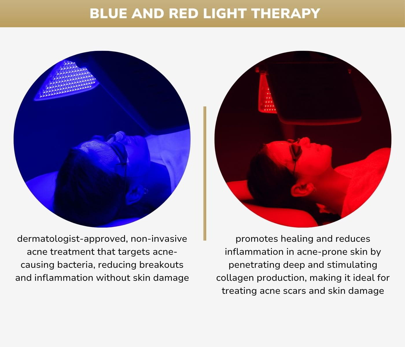 blue and red light therapy