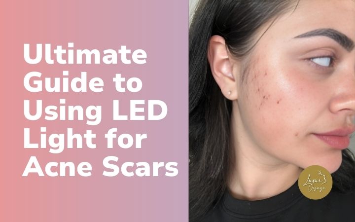 Using LED Light for Acne Scars