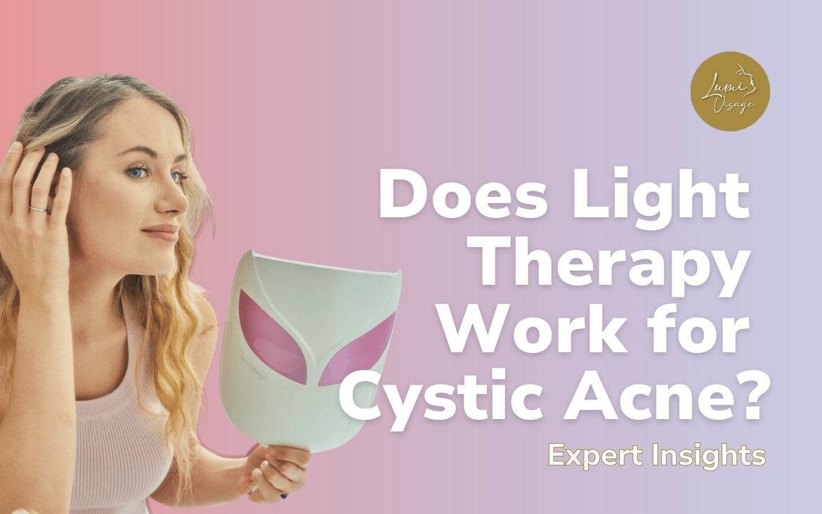 does-light therapy work for cystic acne