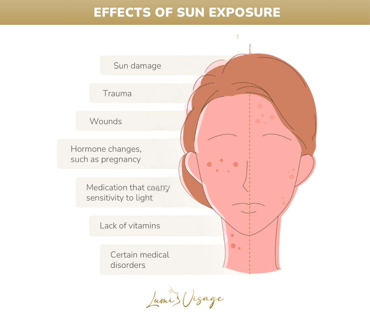 effects of sun exposure