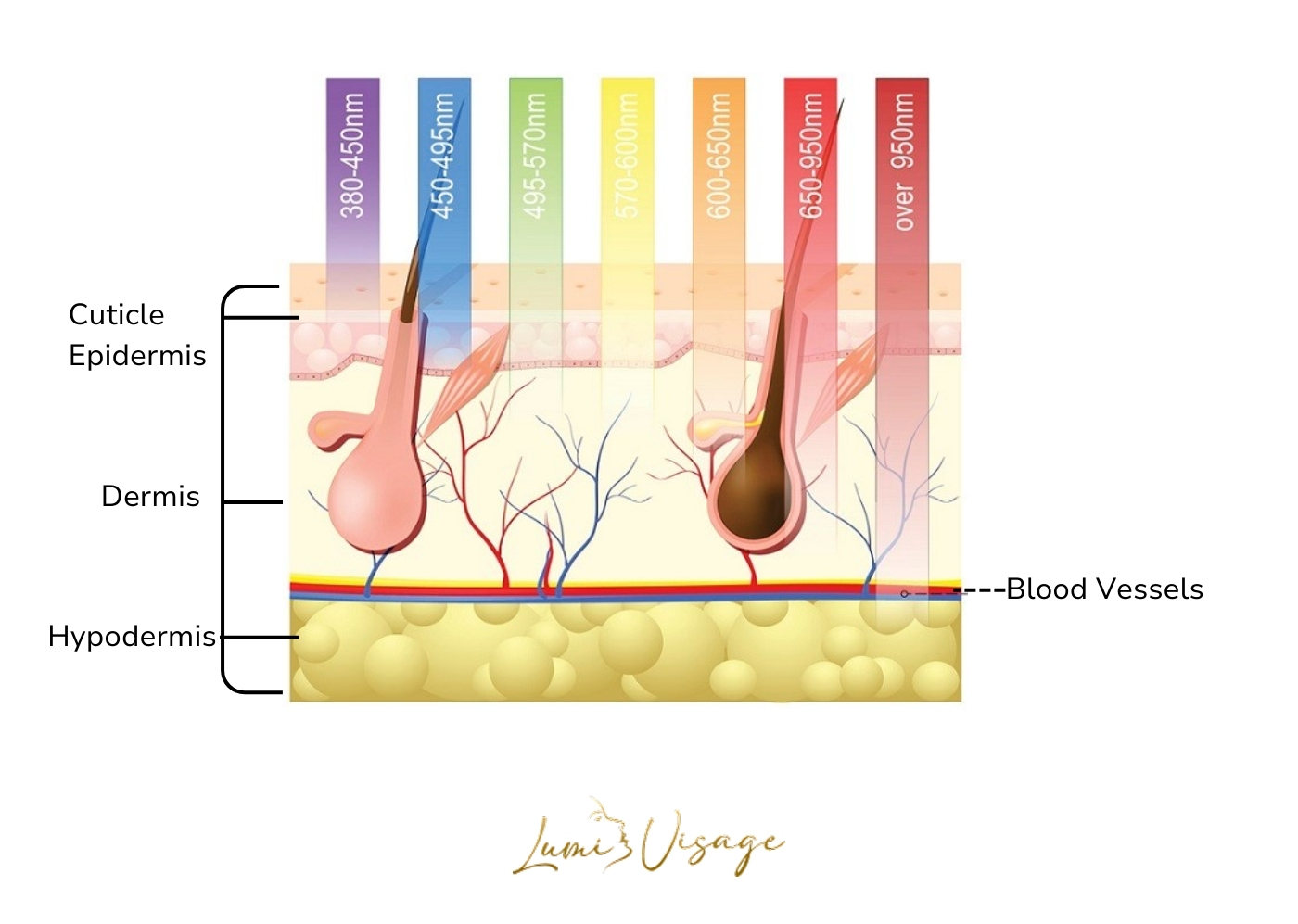 infrared-therapy
