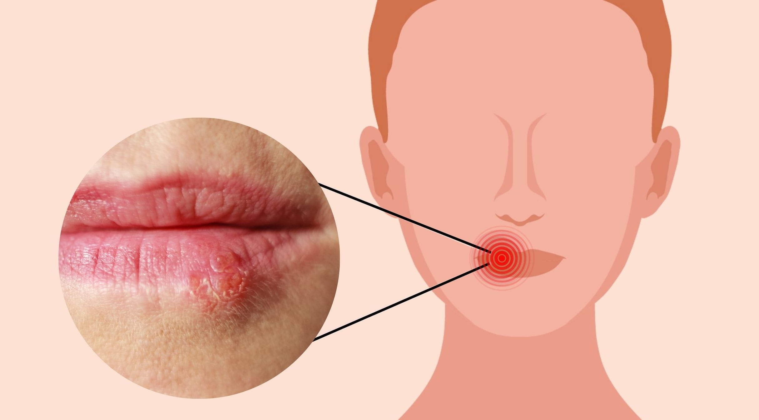 red inflammation