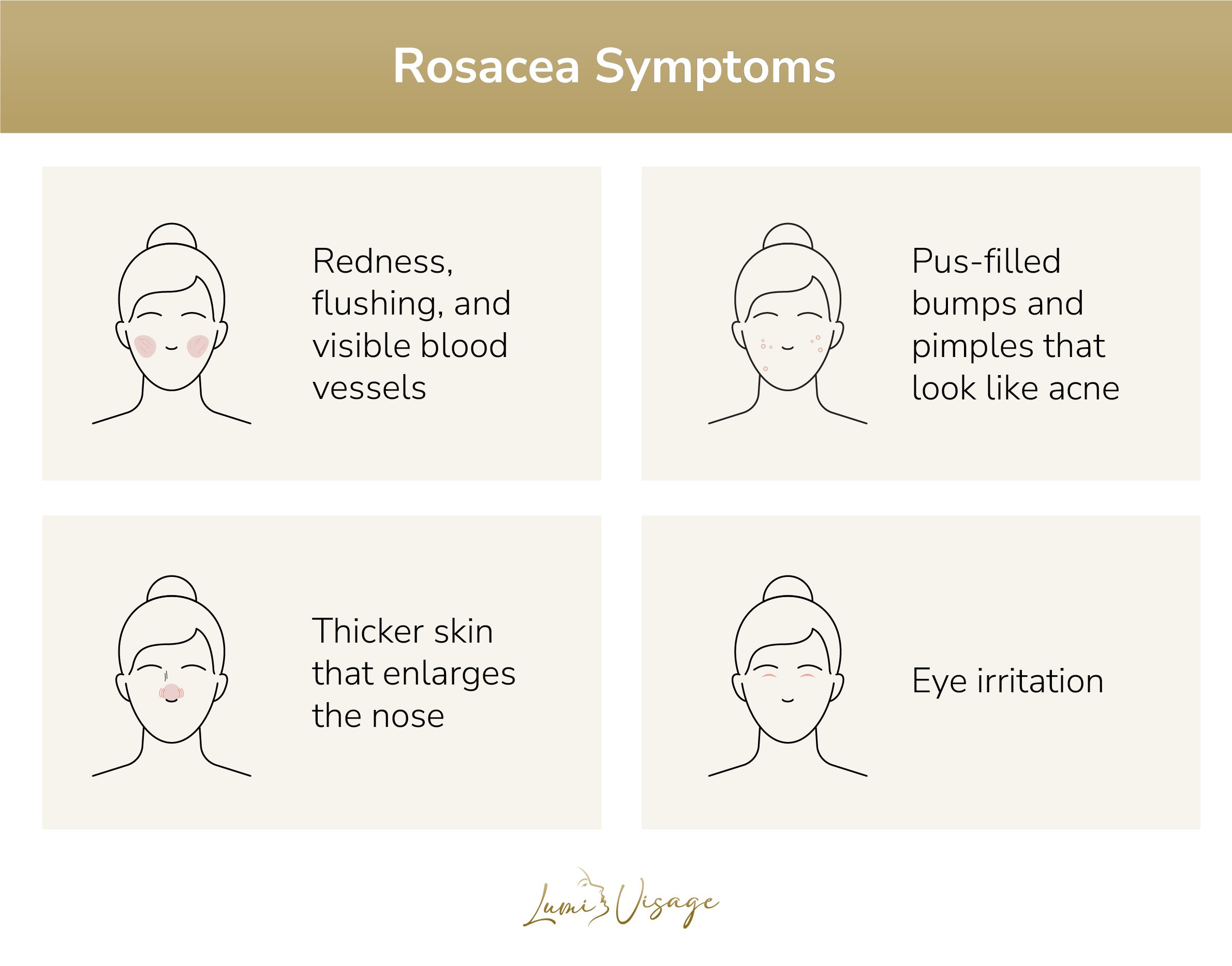 rosacea symptoms