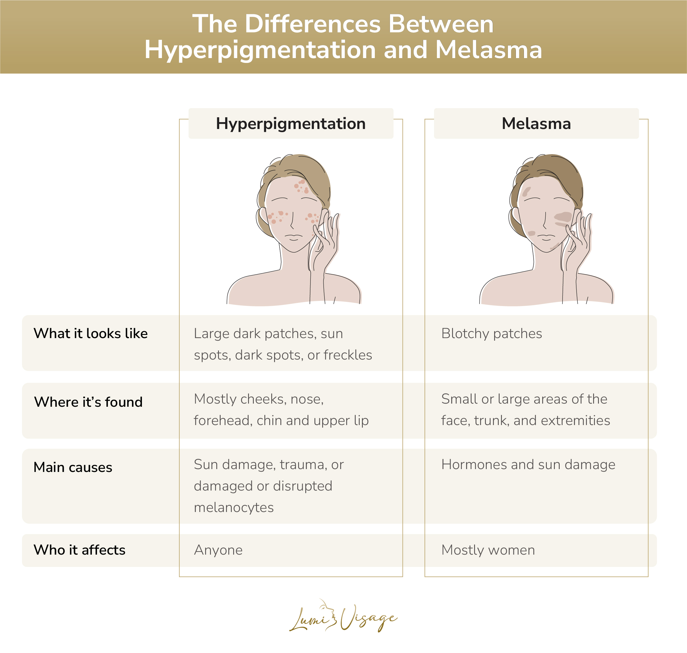 the differences between hyperpigmentation and melasma