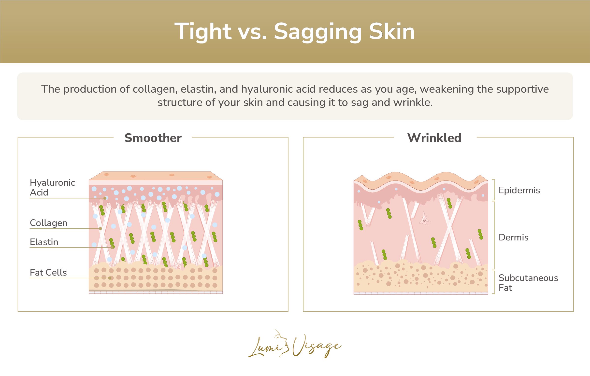 tight vs sagging skin