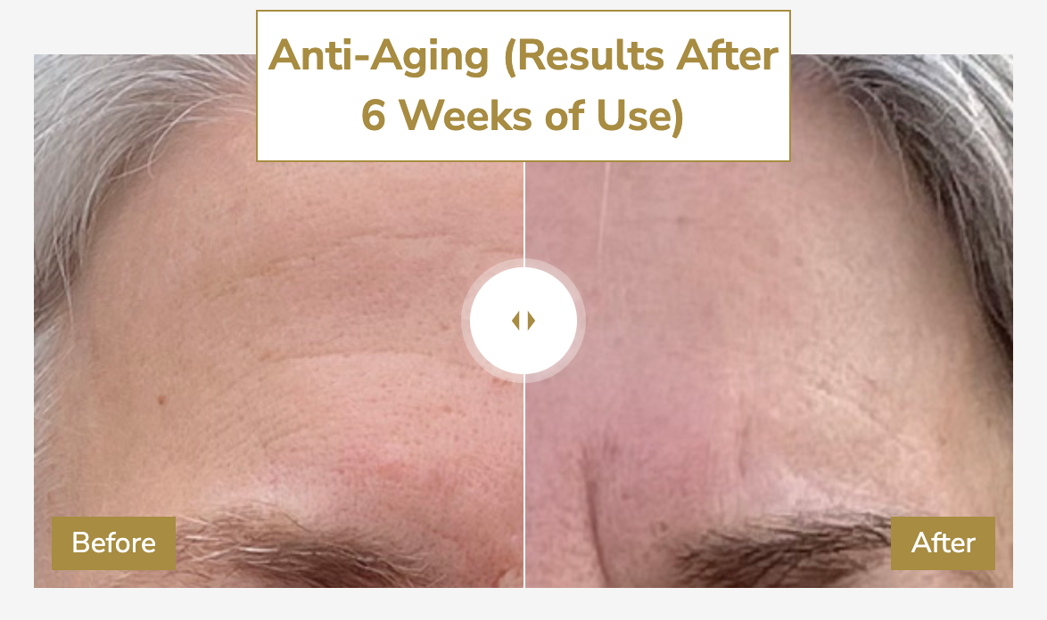 before/after